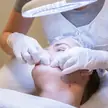 Acné bij Dermavita Huidtherapie Zaandam