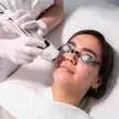 Elektrische epilatie bij Dermavita Huidtherapie Zaandam