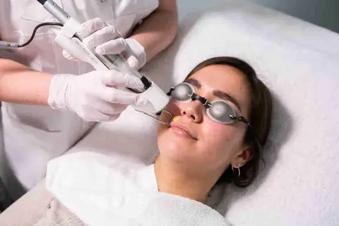 Elektrische epilatie bij Dermavita Huidtherapie Zaandam