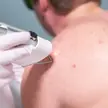 Huidoneffenheden bij Dermavita Huidtherapie Zaandam